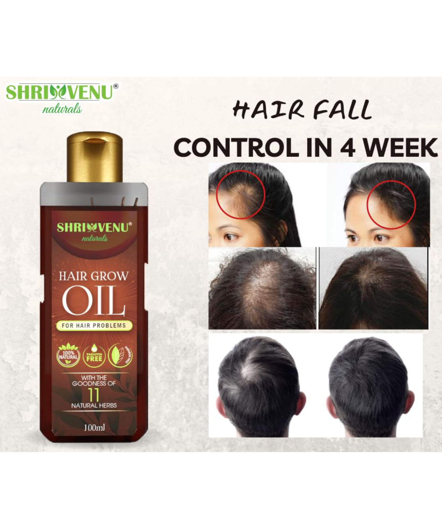 Shrivenu Hair fall control herbal growth anti-hair fall oil 100ml